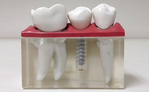 Consultório Implante Dentário Ideali Espaço Multi Odonto