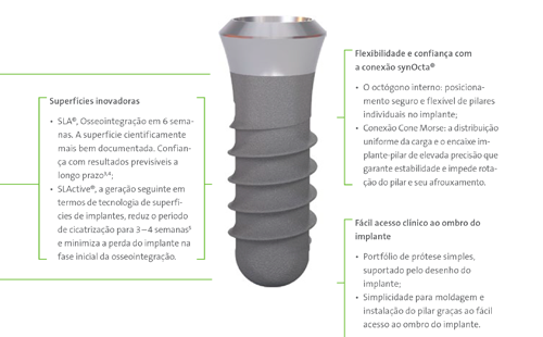 Tipos de Implante Dentário